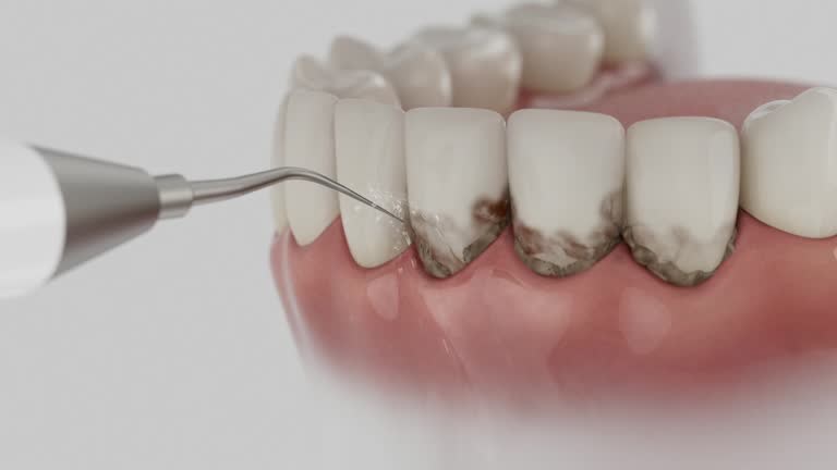 Reliable Dental contractor in Rensselaer, IN by Dentist Open Now